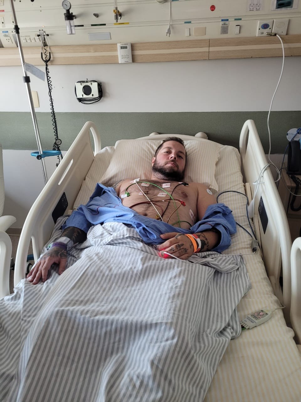 Hospital bed after widowmaker heart attack — wires, monitors, ICU